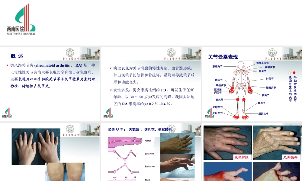 RA(医师协会重庆继教).ppt