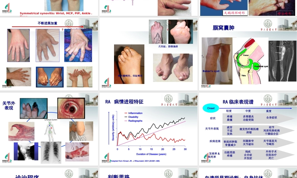 RA(医师协会重庆继教).ppt