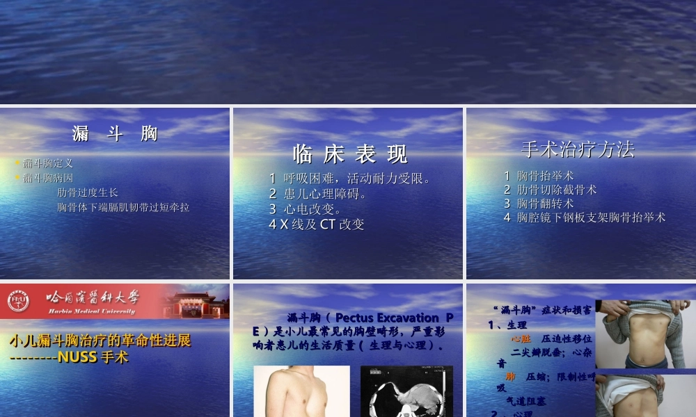 114外科-胸壁疾病(1).ppt