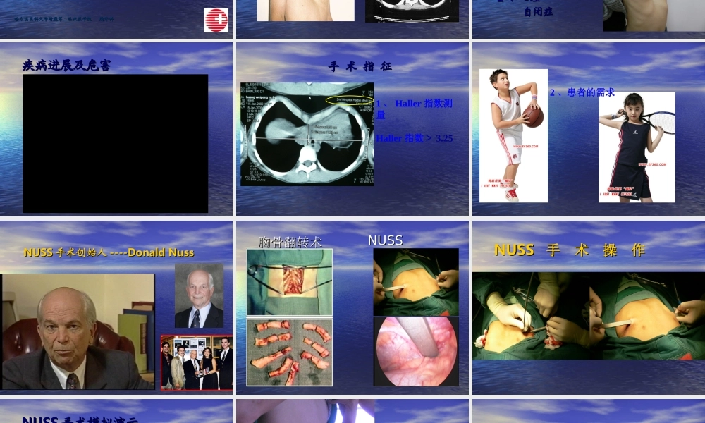 114外科-胸壁疾病(1).ppt