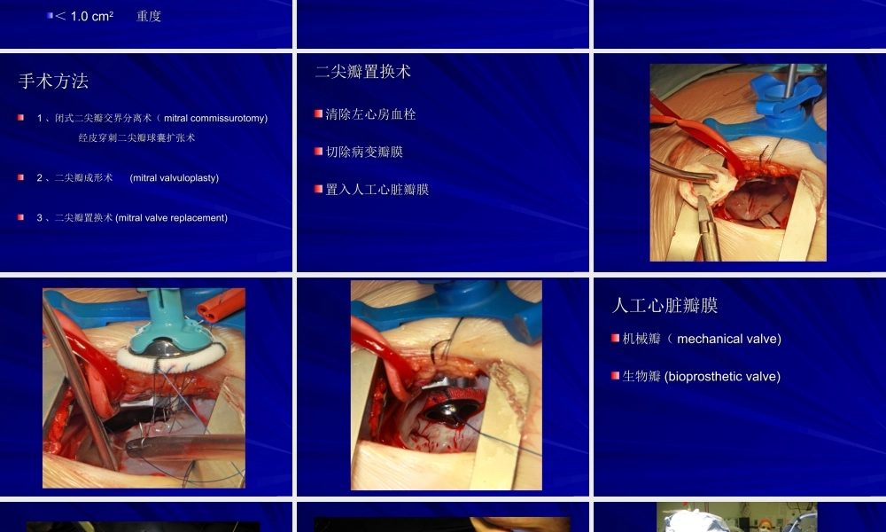 145心血管内科-后心病 (1).ppt