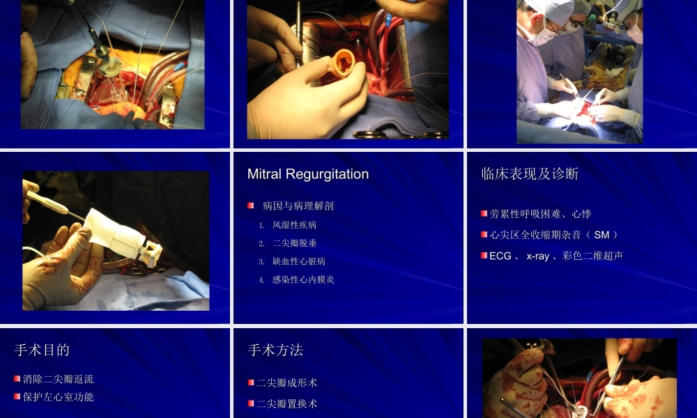 145心血管内科-后心病 (1).ppt