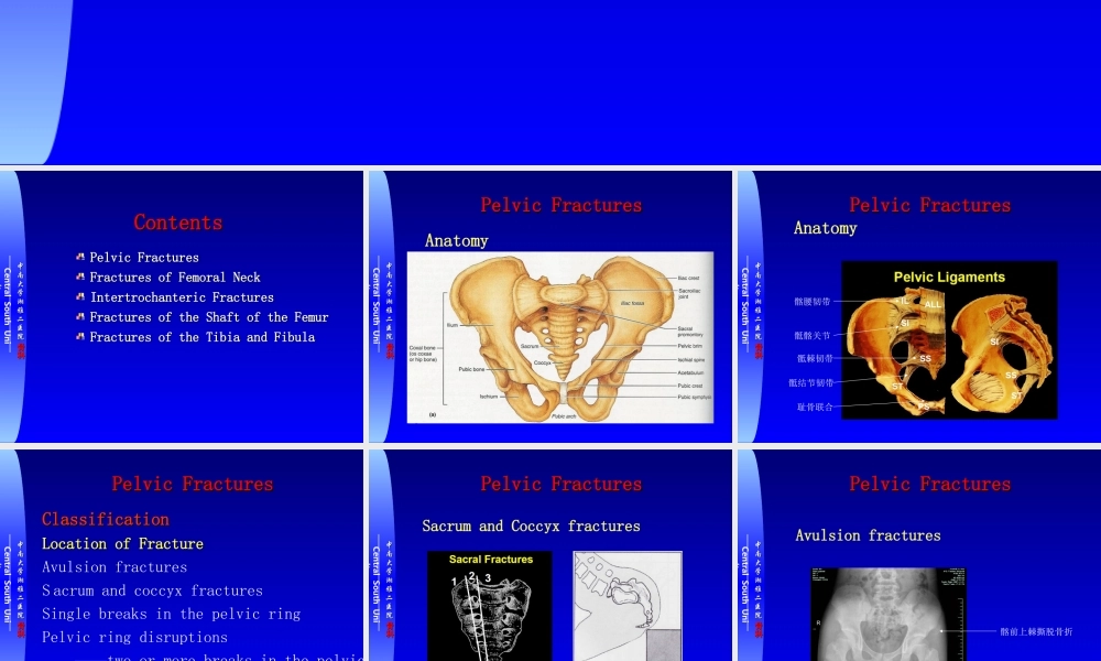 17骨科-骨盆骨折与下肢骨折(1).ppt