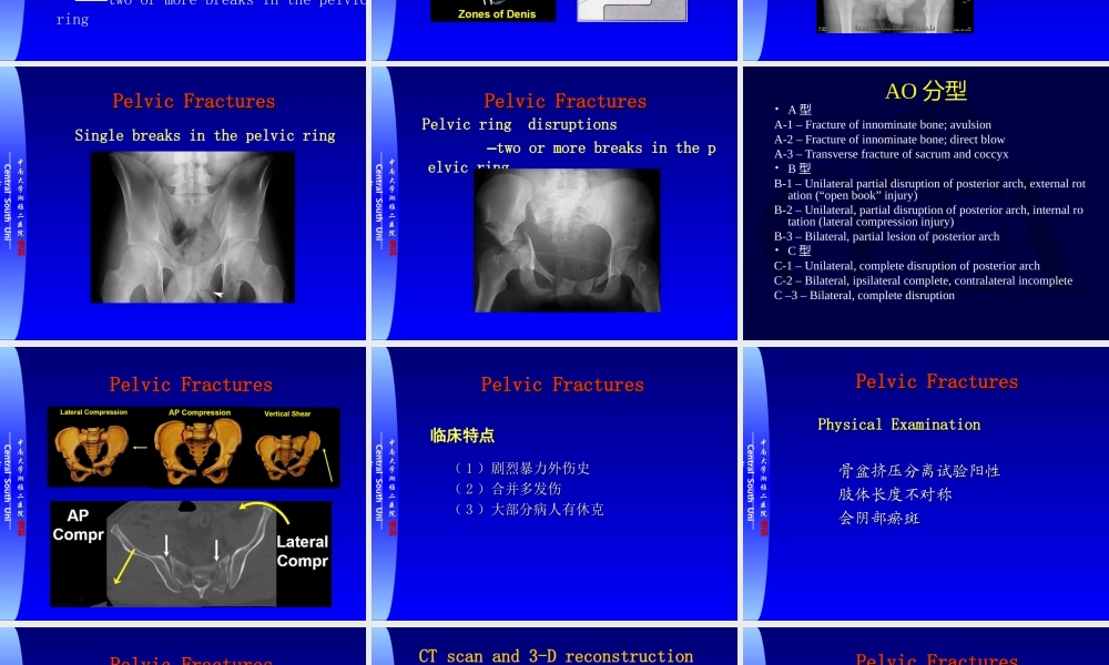 17骨科-骨盆骨折与下肢骨折(1).ppt