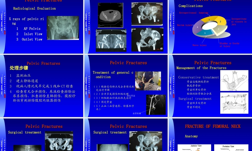 17骨科-骨盆骨折与下肢骨折(1).ppt