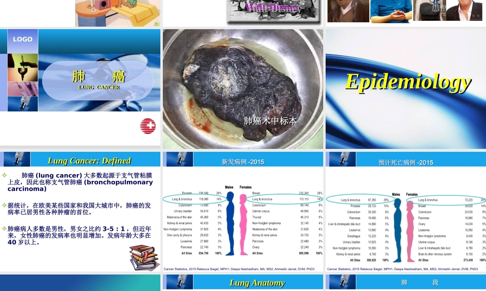 152肿瘤科-肺癌-新 - 副本(1).ppt