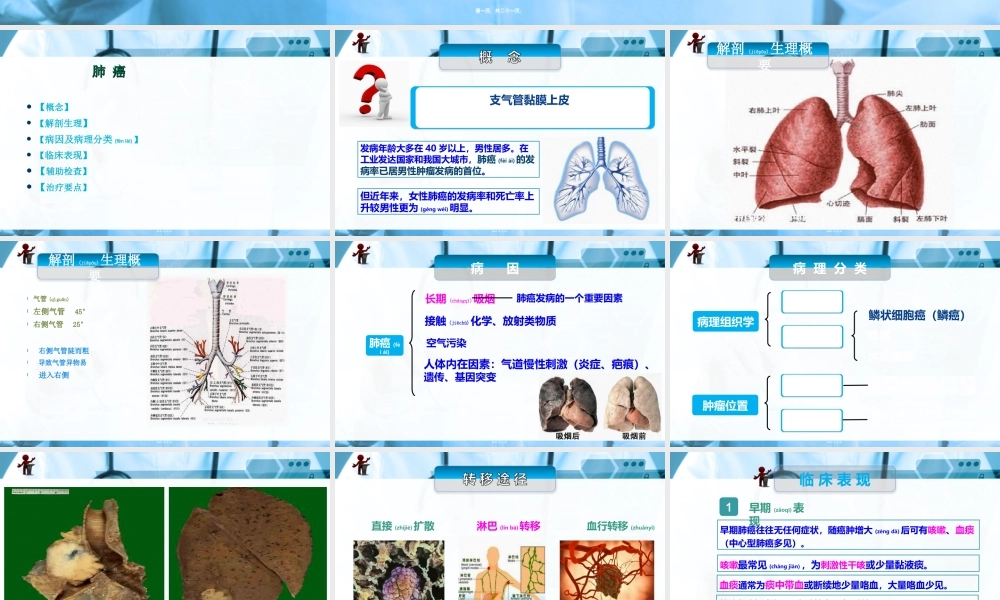 2022年医学专题—、肺癌.ppt