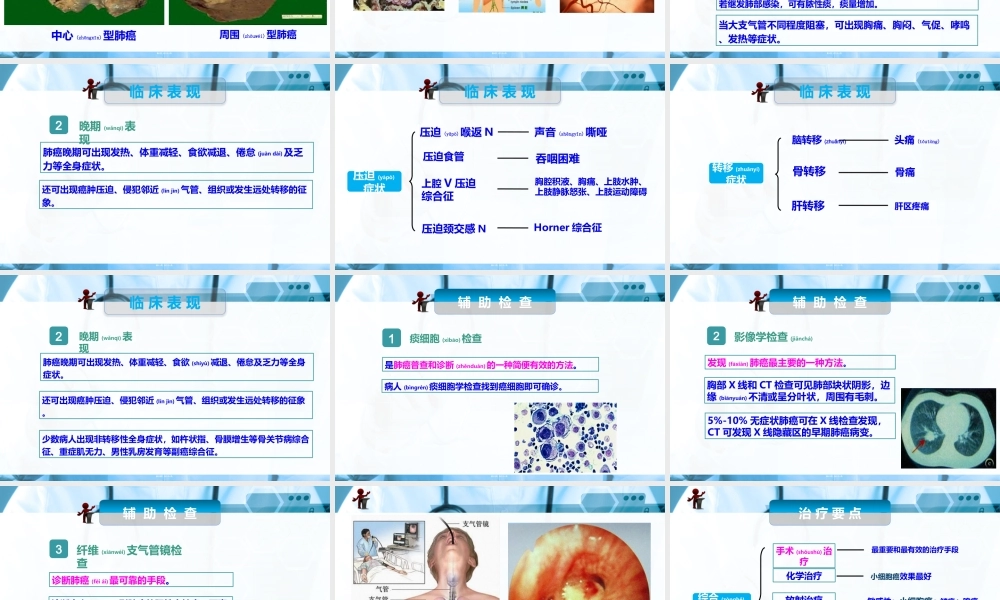 2022年医学专题—、肺癌.ppt