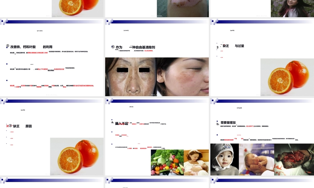 2022年医学专题—《食品营养与卫生》-第七讲-水溶性维生素-2016测试版.ppt