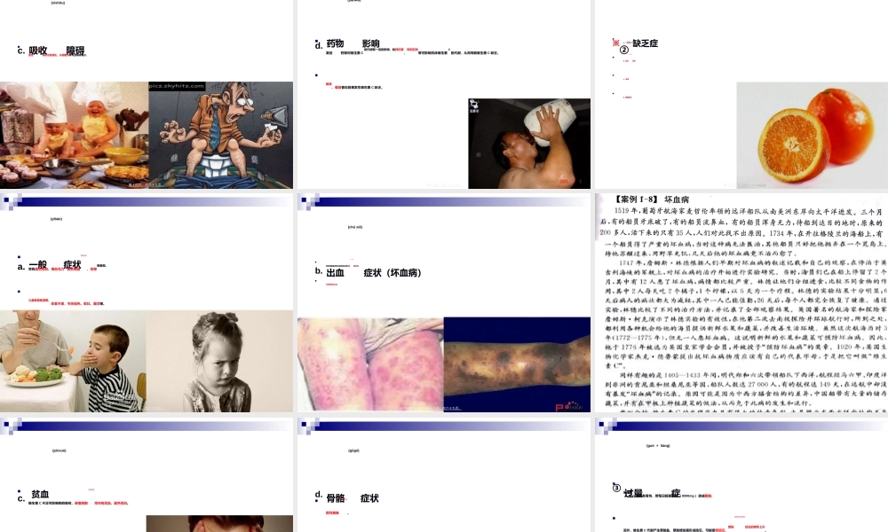 2022年医学专题—《食品营养与卫生》-第七讲-水溶性维生素-2016测试版.ppt