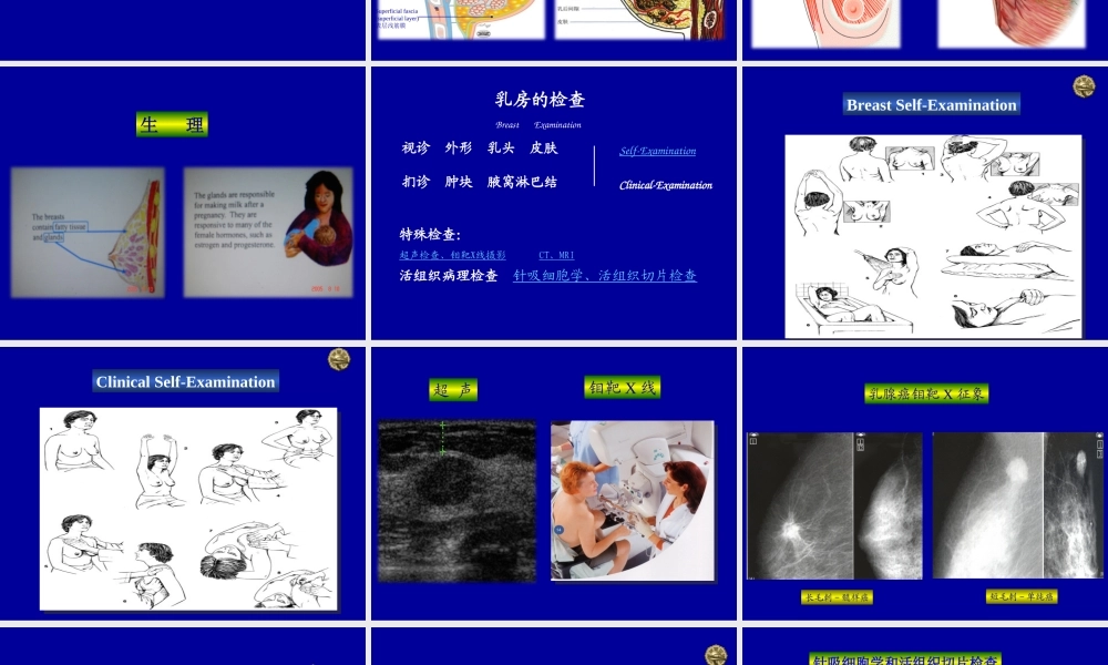 13妇产科-乳房疾病(1).ppt