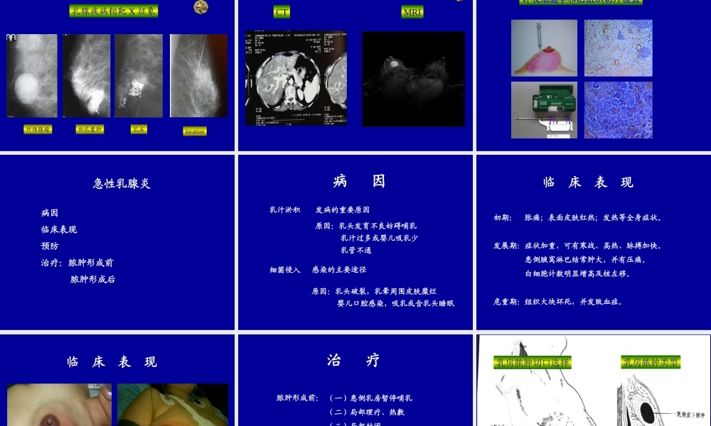 13妇产科-乳房疾病(1).ppt