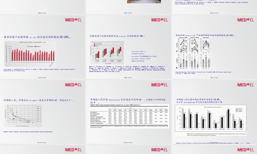 2022年医学专题—双侧人工耳蜗植入.ppt