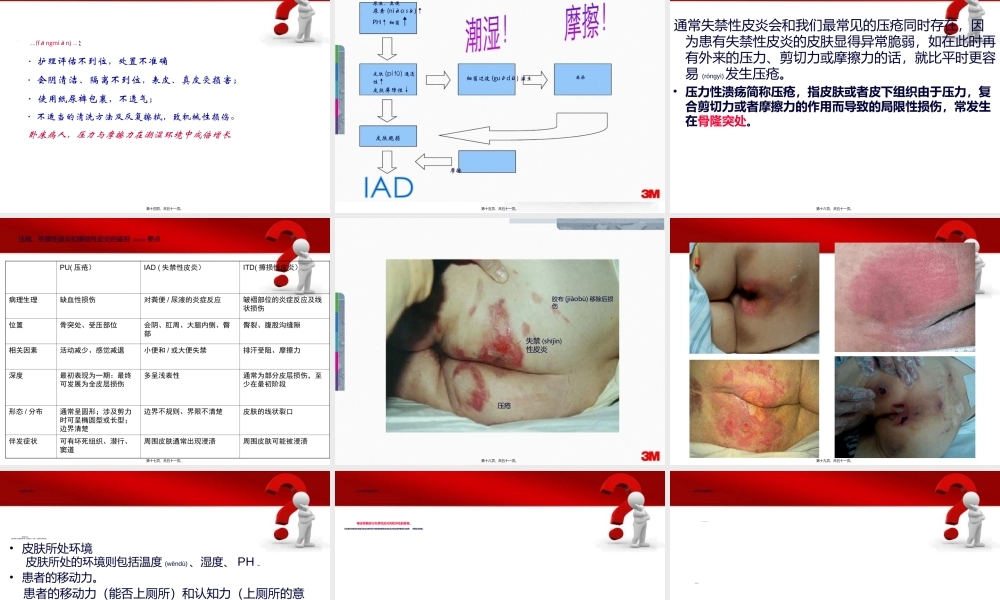 2022年医学专题—失禁性皮炎讲稿.ppt