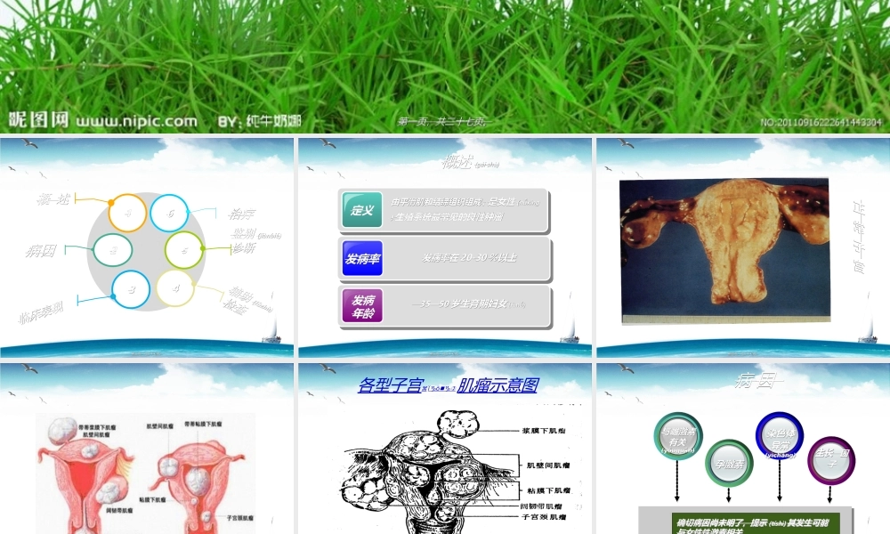 2022年医学专题—子宫肌瘤的诊治.ppt