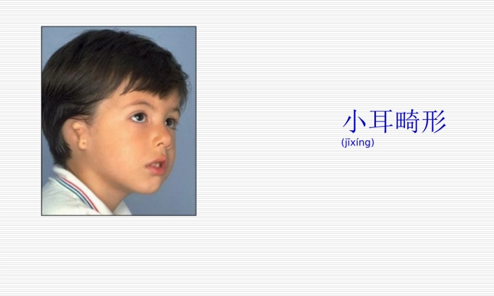 2022年医学专题—小耳畸形重建.ppt