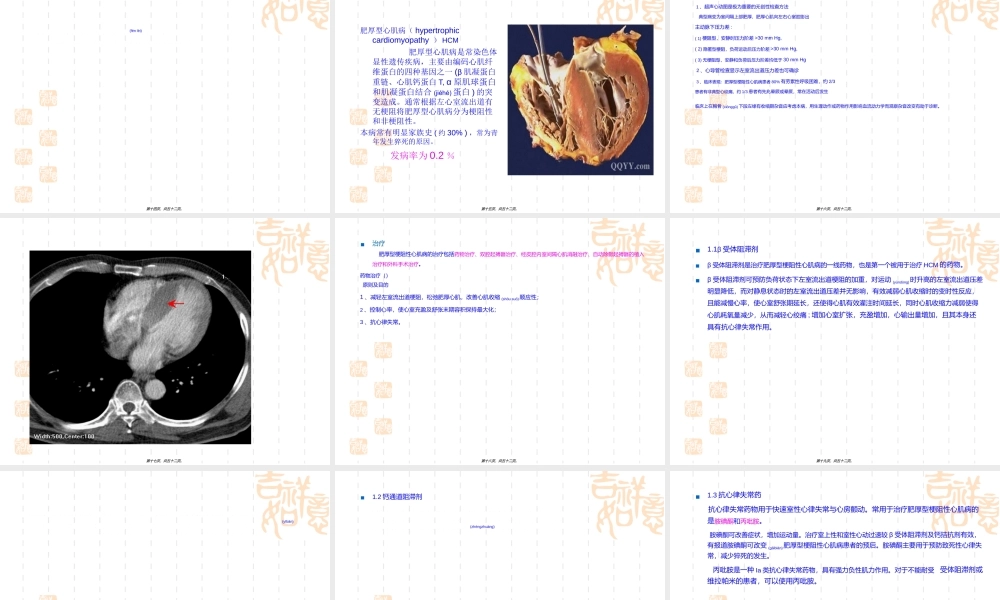 2022年医学专题—心肌病的分类及诊治.ppt