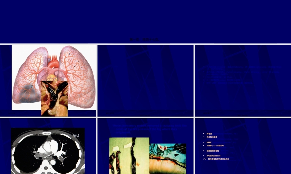 2022年医学专题—急性肺血栓栓塞症.ppt
