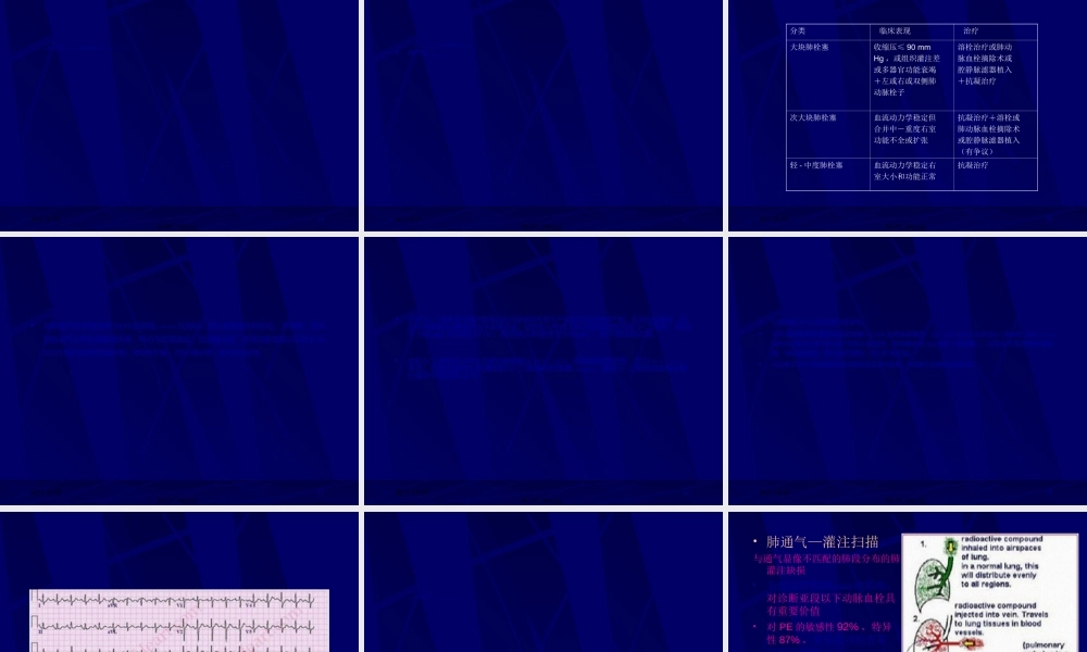 2022年医学专题—急性肺血栓栓塞症.ppt