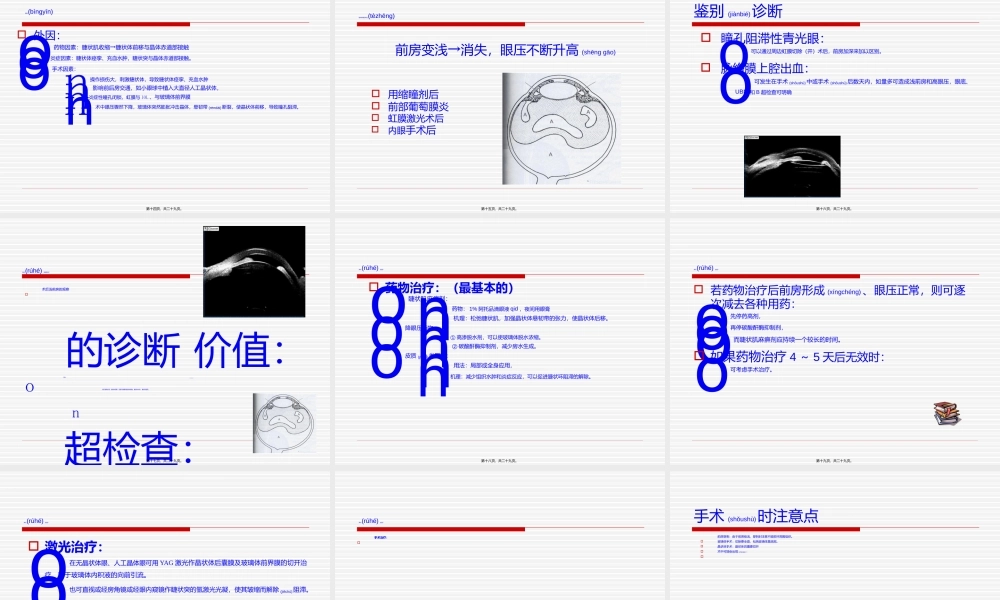2022年医学专题—恶性青光眼病例分析讲诉.ppt