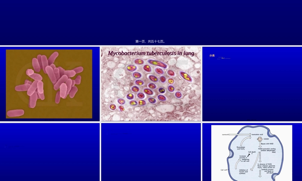 2022年医学专题—抗结核病药及抗麻风病药..ppt