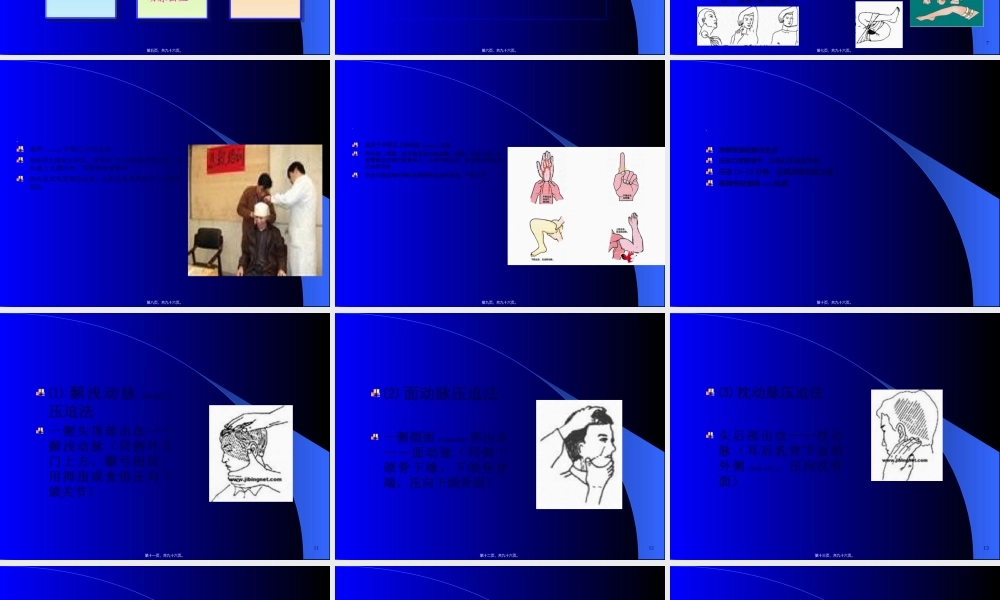 2022年医学专题—止血包扎与外科换药技术.ppt