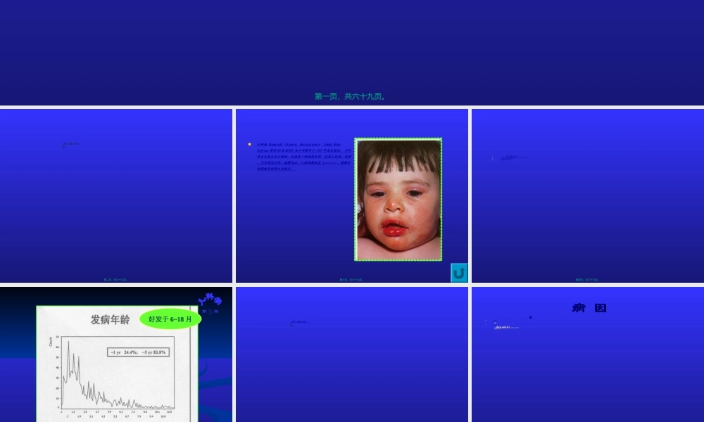 2022年医学专题—皮肤黏膜淋巴结综合征.ppt