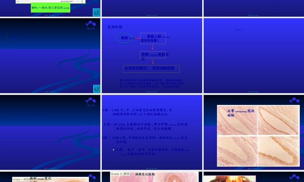 2022年医学专题—皮肤黏膜淋巴结综合征.ppt