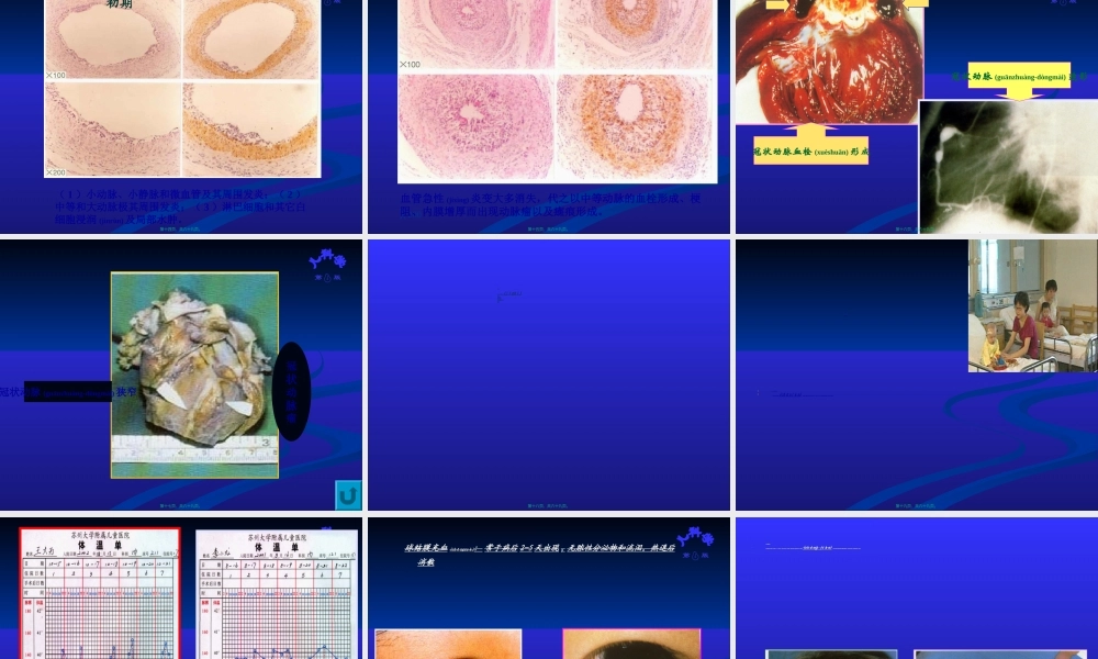 2022年医学专题—皮肤黏膜淋巴结综合征.ppt