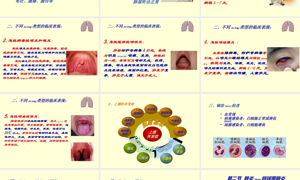 2022年医学专题—第三章-急性上呼吸道感染.ppt
