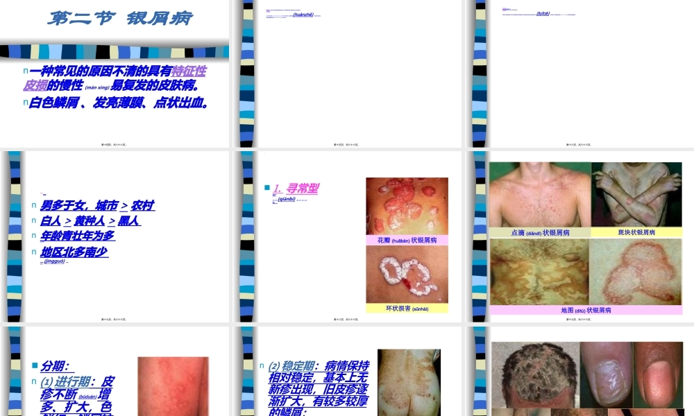 2022年医学专题—第十一章-红斑鳞屑性皮肤病.ppt
