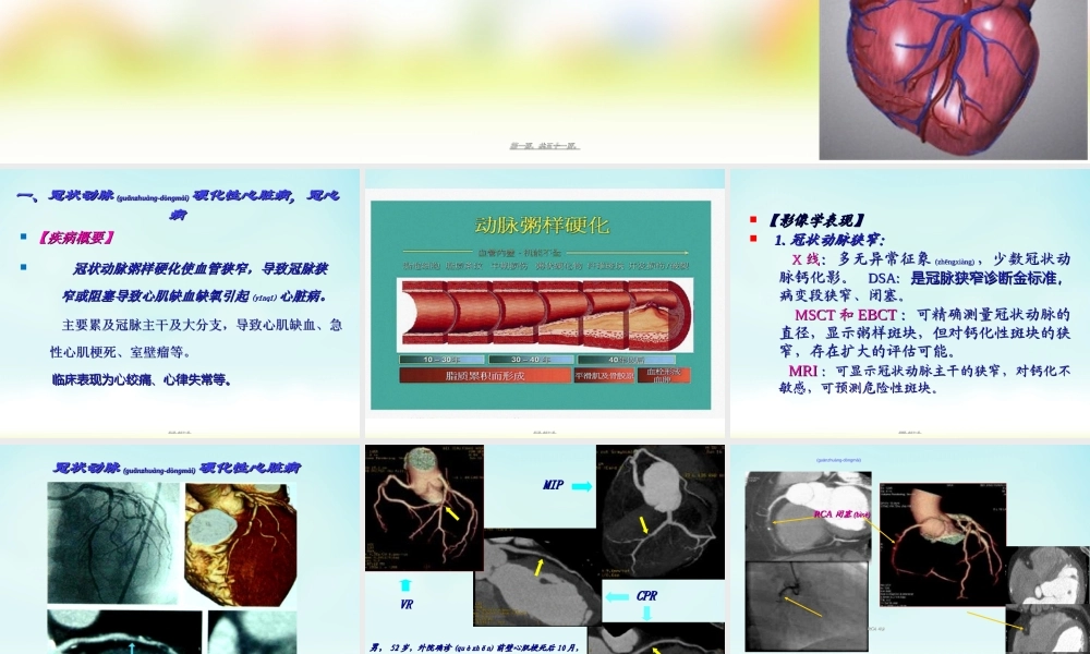 2022年医学专题—第四节-后天性心脏病I.ppt