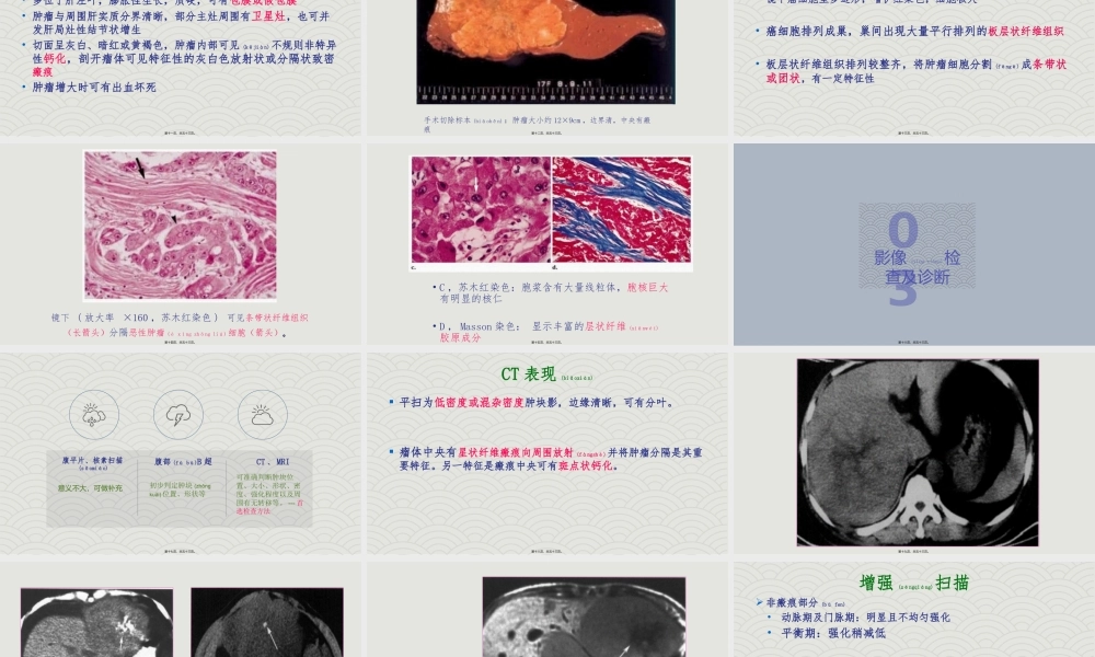2022年医学专题—纤维板层型肝癌.pptx