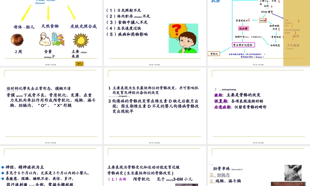 2022年医学专题—维生素D缺乏症.ppt1...ppt