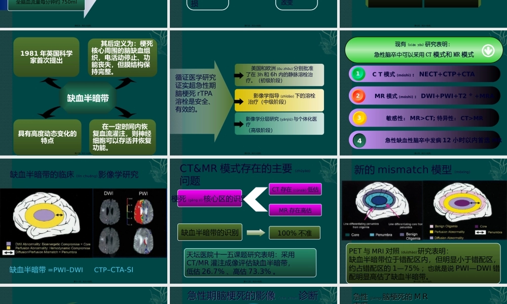 2022年医学专题—缺血性脑卒中.pptx