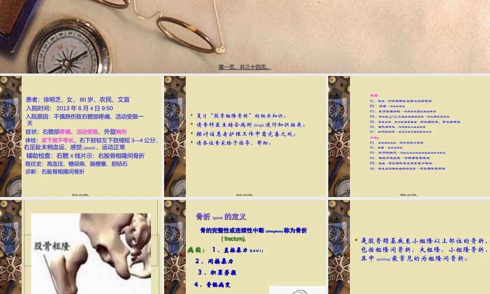 2022年医学专题—股骨粗隆间骨折新.ppt