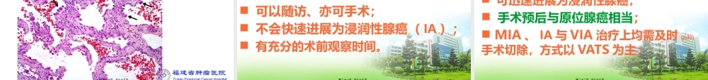2022年医学专题—肺小结节的诊疗体会.pptx