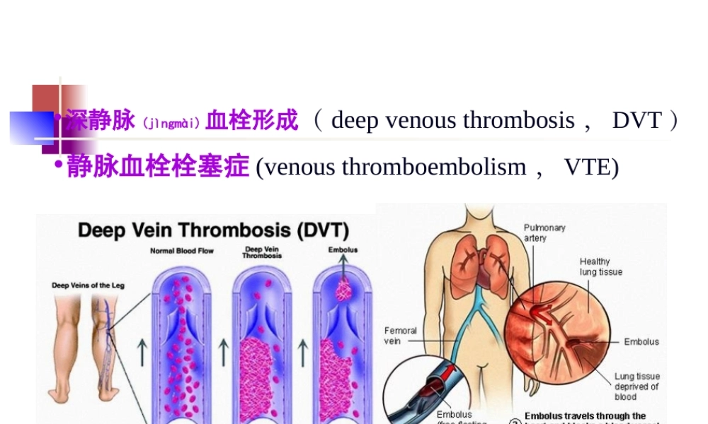2022年医学专题—肺血栓栓塞症的诊治2015.ppt
