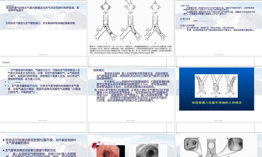 2022年医学专题—肺隔离.ppt