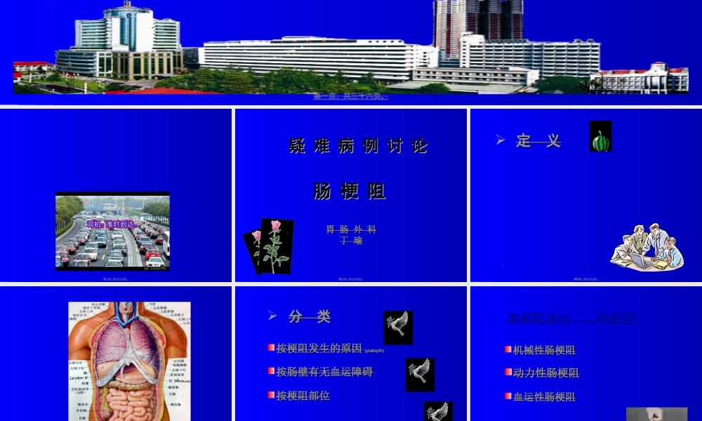 2022年医学专题—胃肠外科肠梗阻疑难病例讨论.ppt