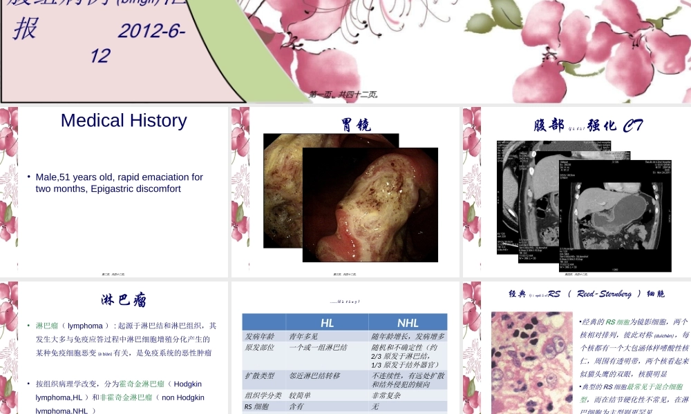 2022年医学专题—胃淋巴瘤-影像学简介.ppt