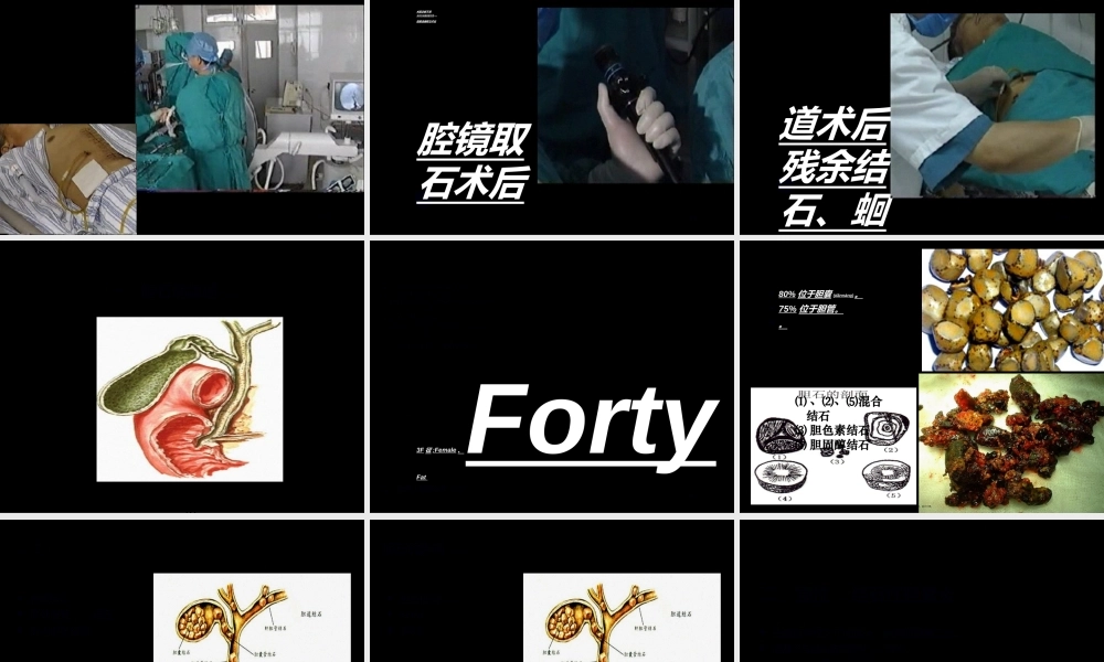 2022年医学专题—胆道外科Cho.ppt