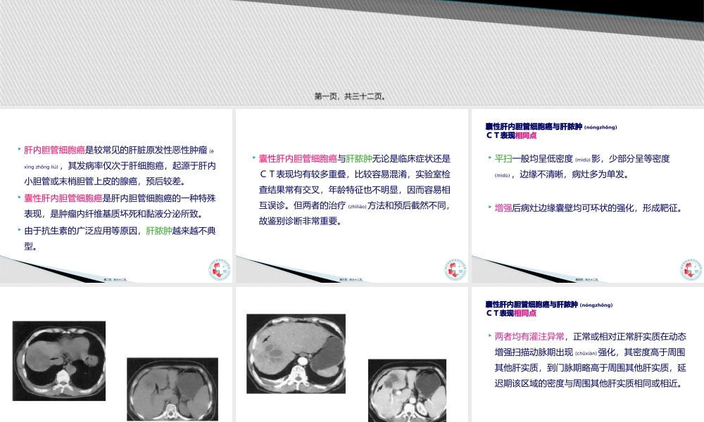 2022年医学专题—胆管细胞癌与肝脓肿的CT鉴别.pptx