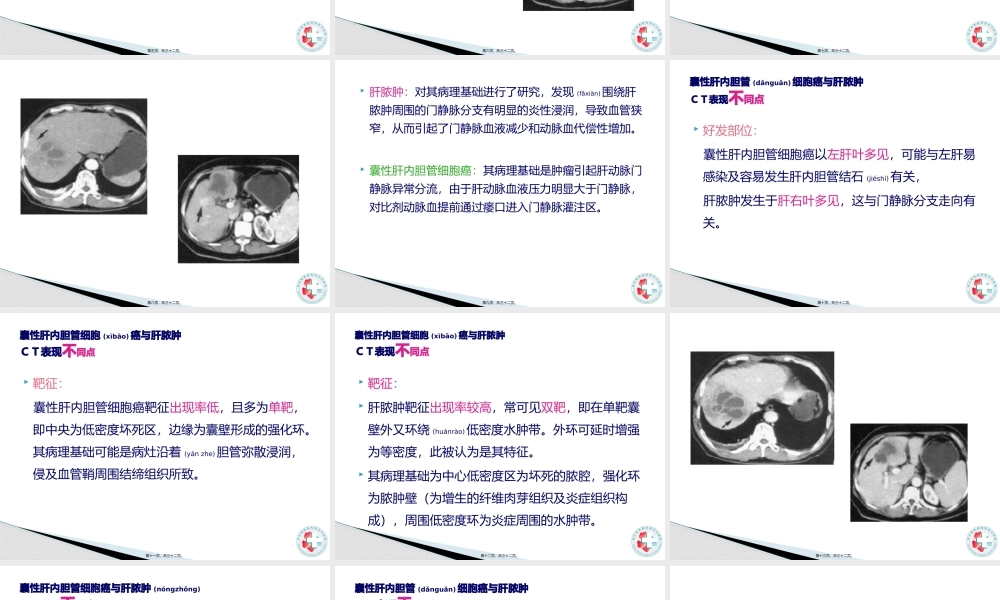 2022年医学专题—胆管细胞癌与肝脓肿的CT鉴别.pptx