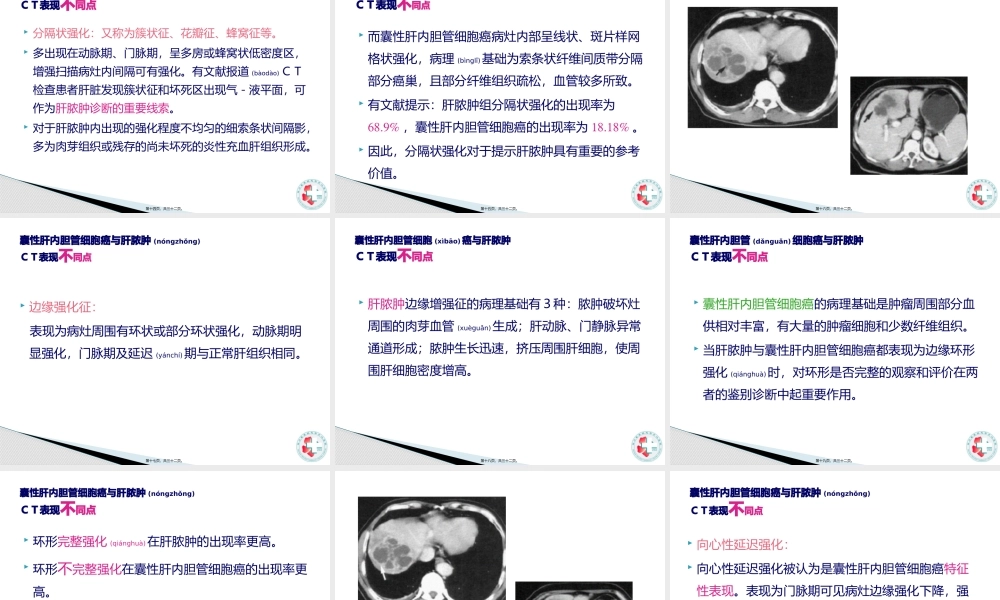 2022年医学专题—胆管细胞癌与肝脓肿的CT鉴别.pptx