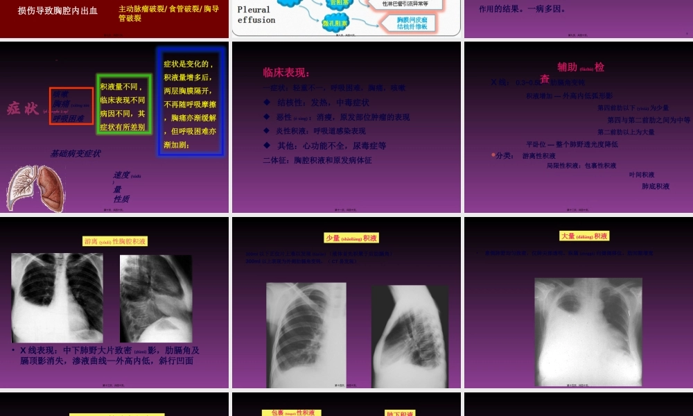 2022年医学专题—胸腔积液-zjy.ppt