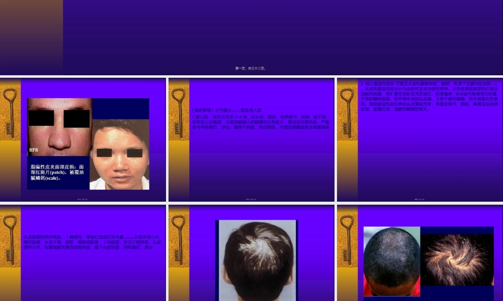 2022年医学专题—脂溢性皮炎...ppt