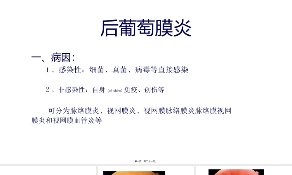 2022年医学专题—脉络膜血管瘤.pptx