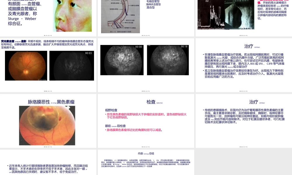 2022年医学专题—脉络膜血管瘤.pptx