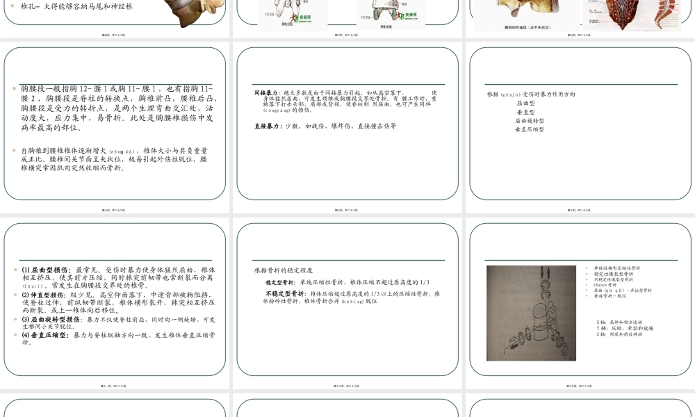 2022年医学专题—腰椎骨折.ppt